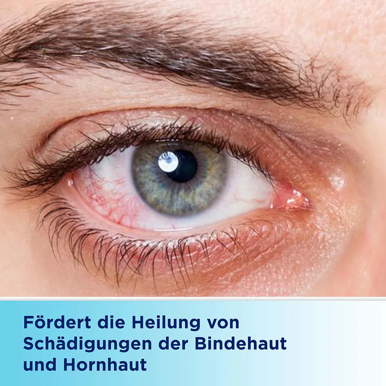 shopapotheke Bepanthen® Augen- und Nasensalbe zur Förderung der Wundheilung Wochenangebot