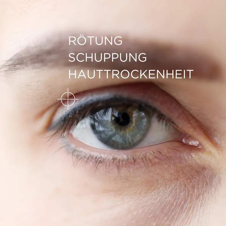 shopapotheke ALLERGIKA® Augenlidcreme MED - Jetzt 2€ sparen mit Code "allmed2" Neueste Stile