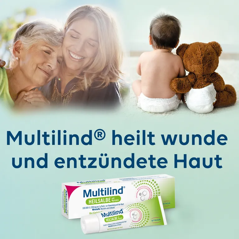 shopapotheke Multilind® Heilsalbe bei wunder und entzündeter Haut mit Zinkoxid und Nystatin - Jetzt 20% mit dem Code stada20 sparen* Tiefpreis