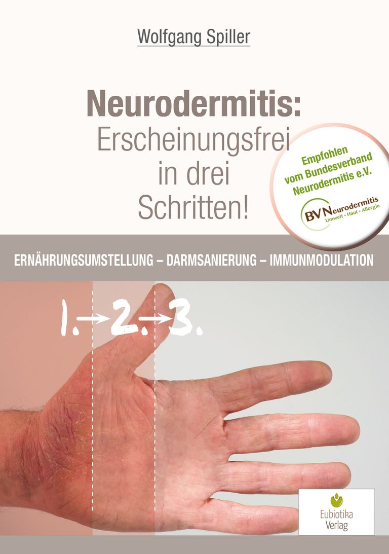 shopapotheke Neurodermitis: Erscheinungsfrei in drei Schritten Großer Ausverkauf