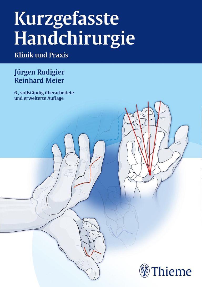 shopapotheke Kurzgefasste Handchirurgie