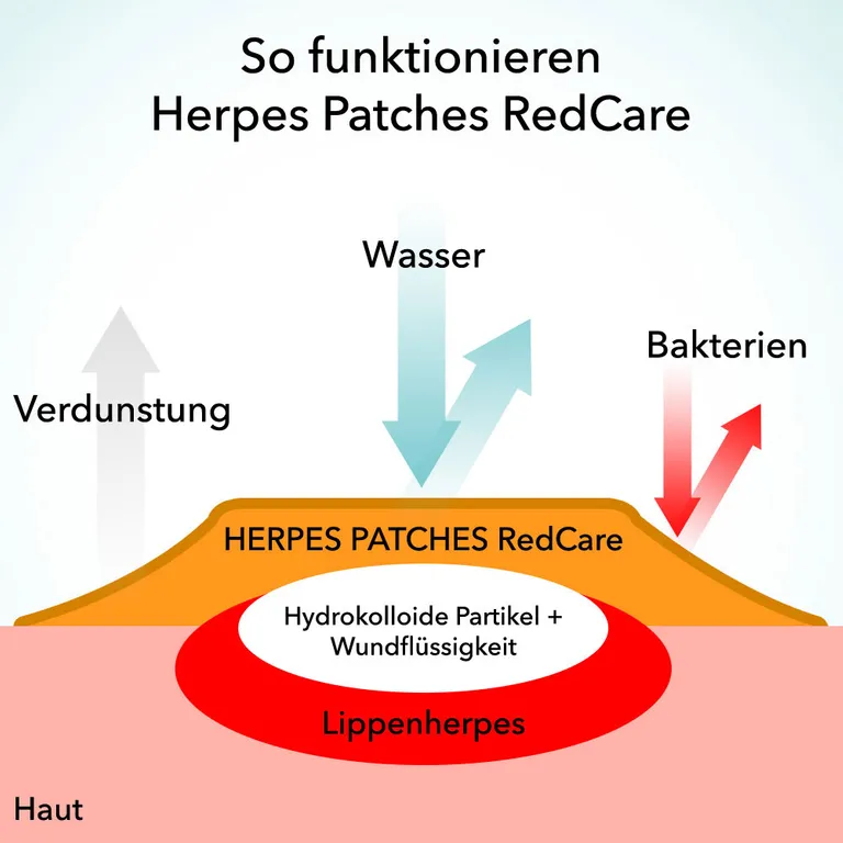 shopapotheke Redcare Herpes Patches Black Friday