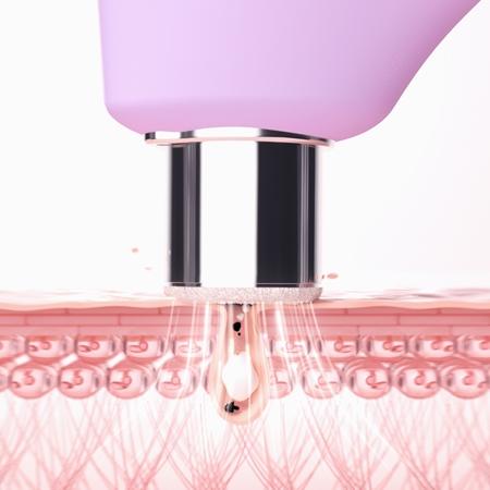 FOREO FOREO KIWI™ Derma Ausrüstung für Diamant-Mikrodermabrasion und Porenreinigung Blitzangebot